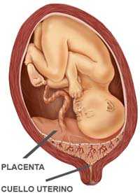 placenta-previa.jpg
