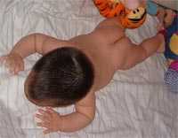 dermatitis-prevenir.jpg