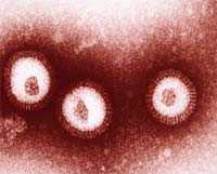 influenza01.jpg