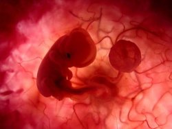 hemofilia-bebe01a.jpg